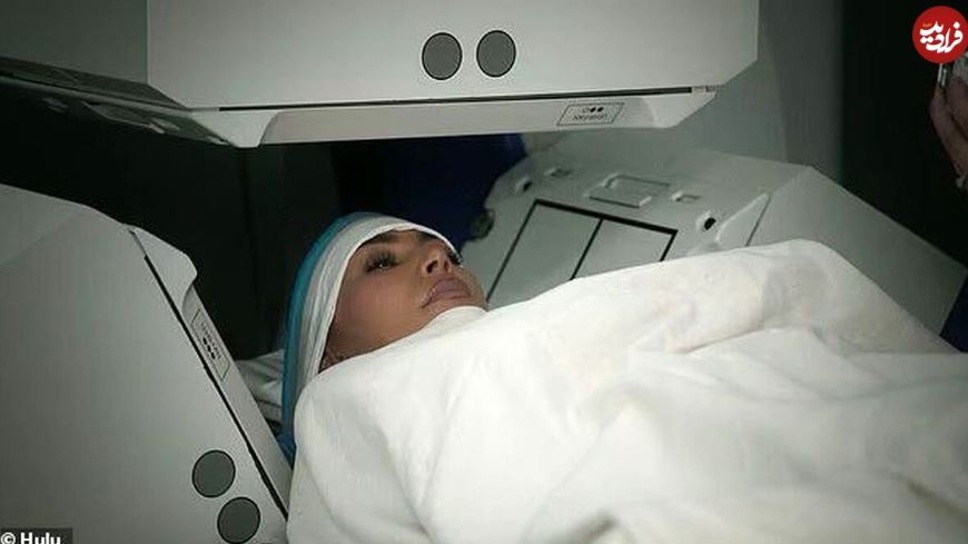 بیماری کیم کارداشیان چیست؟