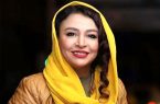 چهره متفاوت مهلقا باقری بعد از عمل زیبایی جلب توجه کرد